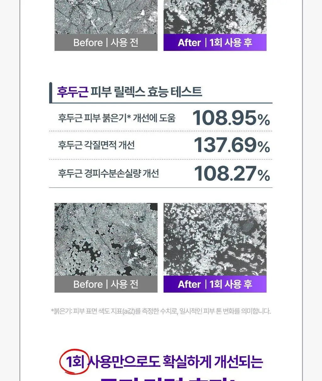 [No.1 헤어/두피 디바이스] 레스노베 하이퍼샷(베이지/핑크) 상세페이지 29